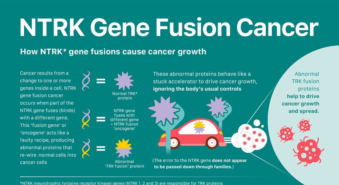 New Infographic: Check out our quick guide to NTRK gene fusion cancer ...